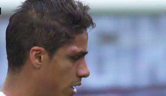 FOTO - Así se retiro Varane del terreno de juego