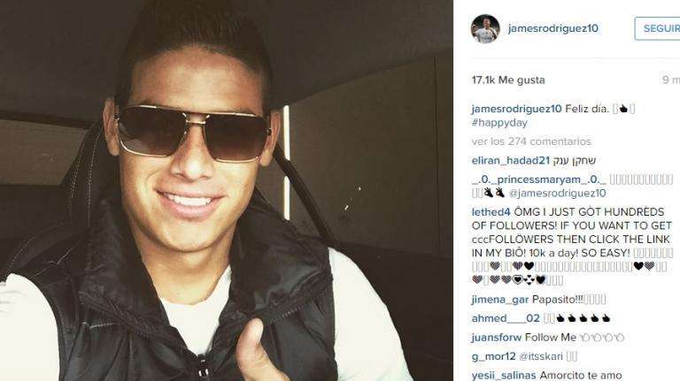 James no pierde la sonrisa a pesar de su lesión