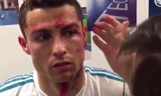 VÍDEO - El Madrid desvela lo que no se vio de la herida de Cristiano Ronaldo