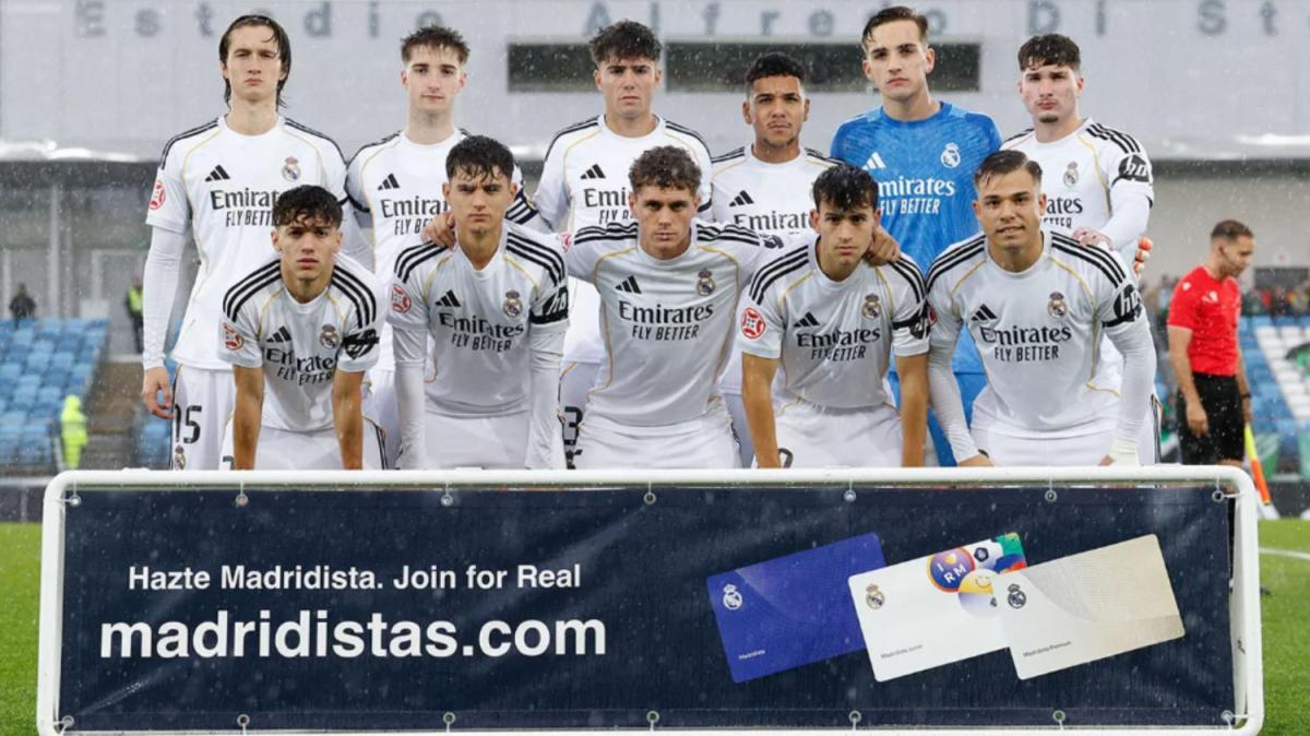 Nueva lesión en el Real Madrid Castilla: podría pasar por el quirófano