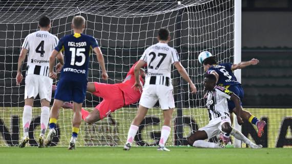 Storgato a RBN: "La Juve ha pagato fisicamente gli impegni ravvicinati, non vedo allarmi"