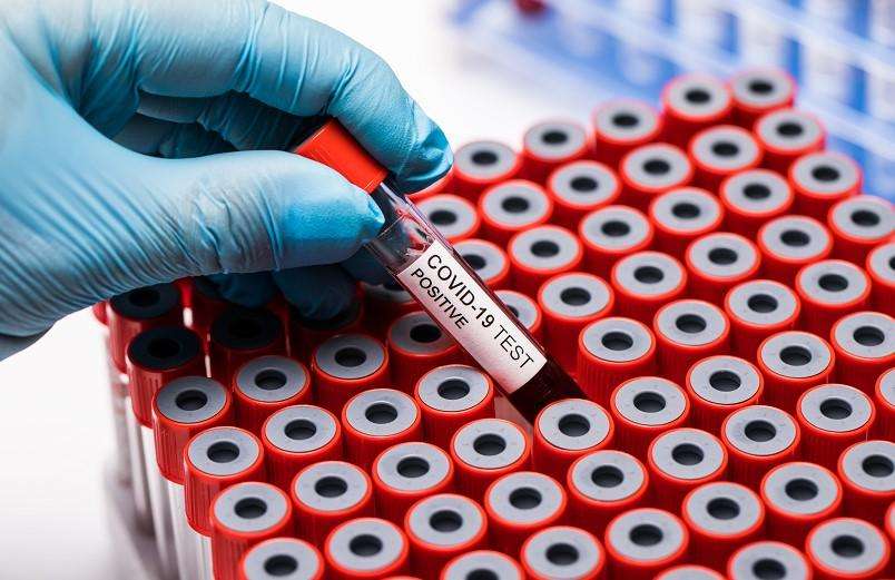 Formula 1 | McLaren, Ricciardo e il Covid-19: 2 possibili sostituti per la 1a gara