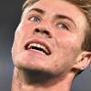 Torino-Napoli, due forfait dell'ultima ora per Conte: out McTominay e Hojlund. Tra 7 giorni c'è l'Inter 