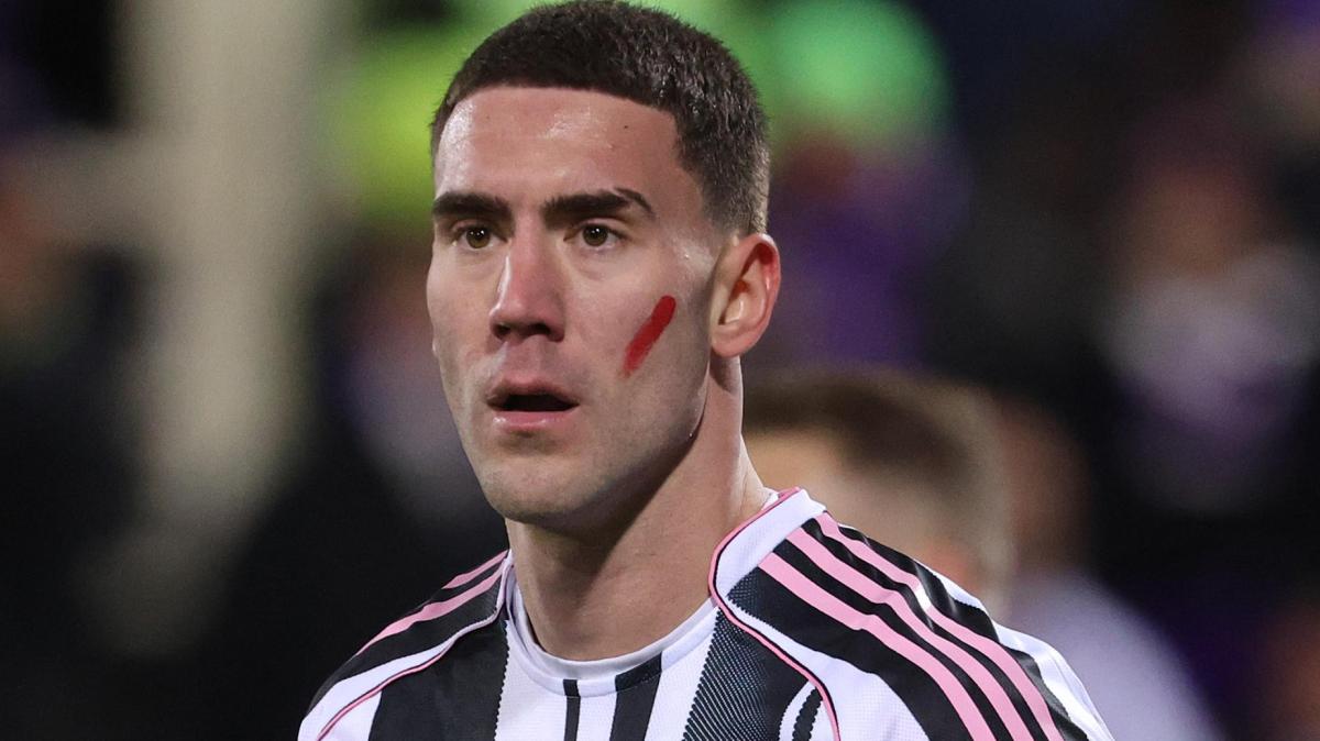 Juventus, tegola Vlahovic: lesione di alto grado, necessari ulteriori consulti medici