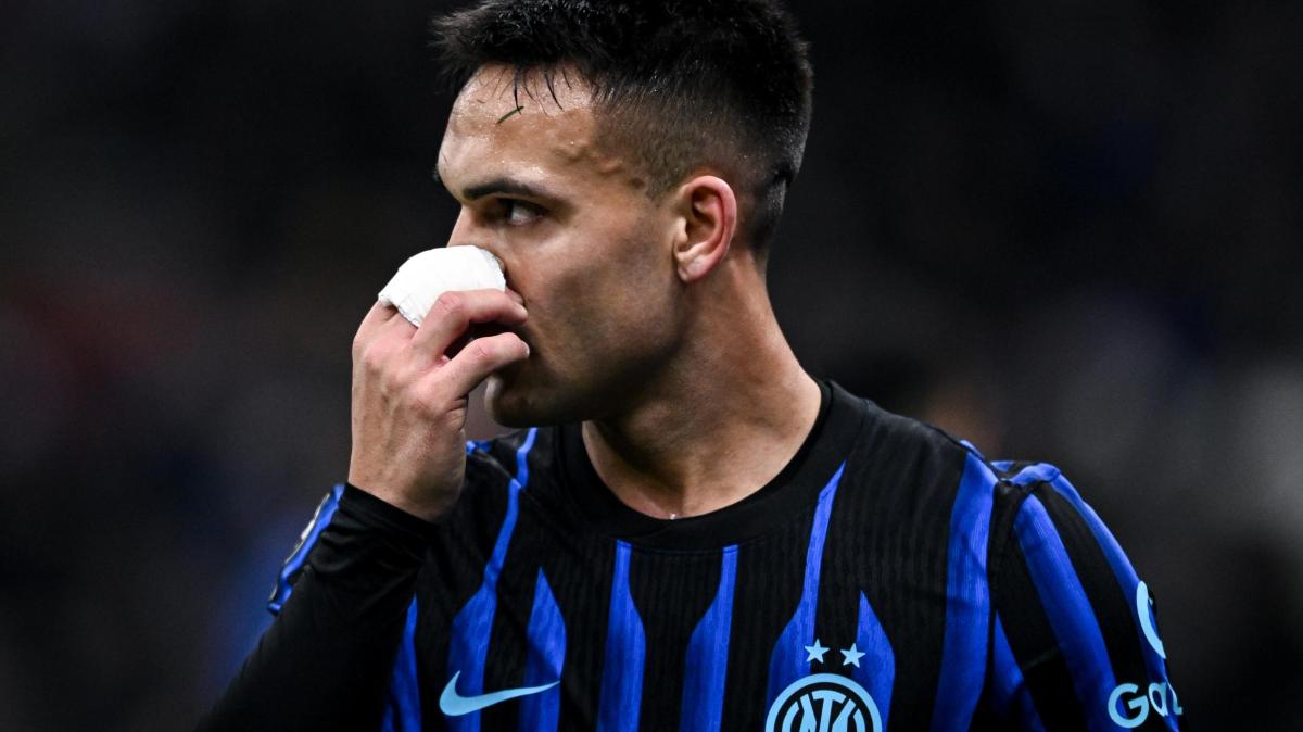 Lautaro e la 'Notte prima degli esami': l'ultima barzelletta sul suo infortunio 'sintetico'