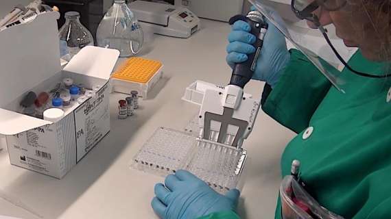 Coronavirus / Partono i test su 5 vaccini in Italia: la biotech Takis ha il via libera