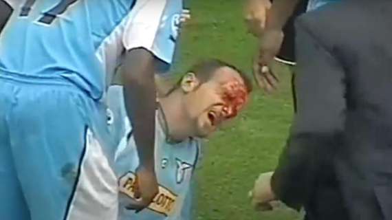 Parma - Lazio, il precedente: quando Rocchi diventò una maschera di sangue