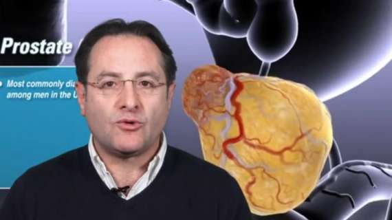 VIDEO - Covid-19, il farmaco per la prostata è utile? Risponde il Prof. Antonini. Lazio e calcio con Vittori: il tg