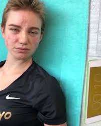 Bebe Vio multata: trovata al bar con amici oltre il coprifuoco per il Covid