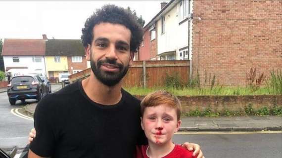 Liverpool, bambino si rompe il naso per vedere Salah - FOTO