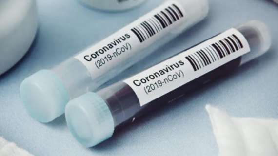 Coronavirus / Regione Lazio, al via 300mila test sierologici: il piano