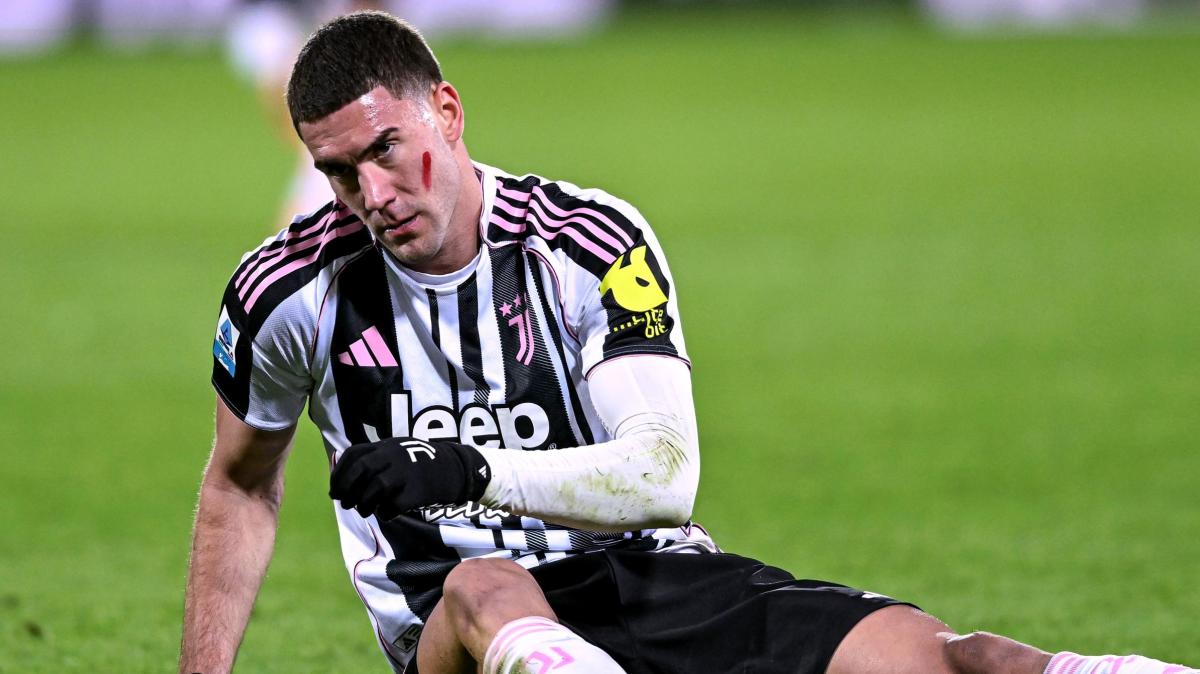 Juve, tegola Vlahovic: lesione di alto grado e lungo stop. Necessari ulteriori consulti