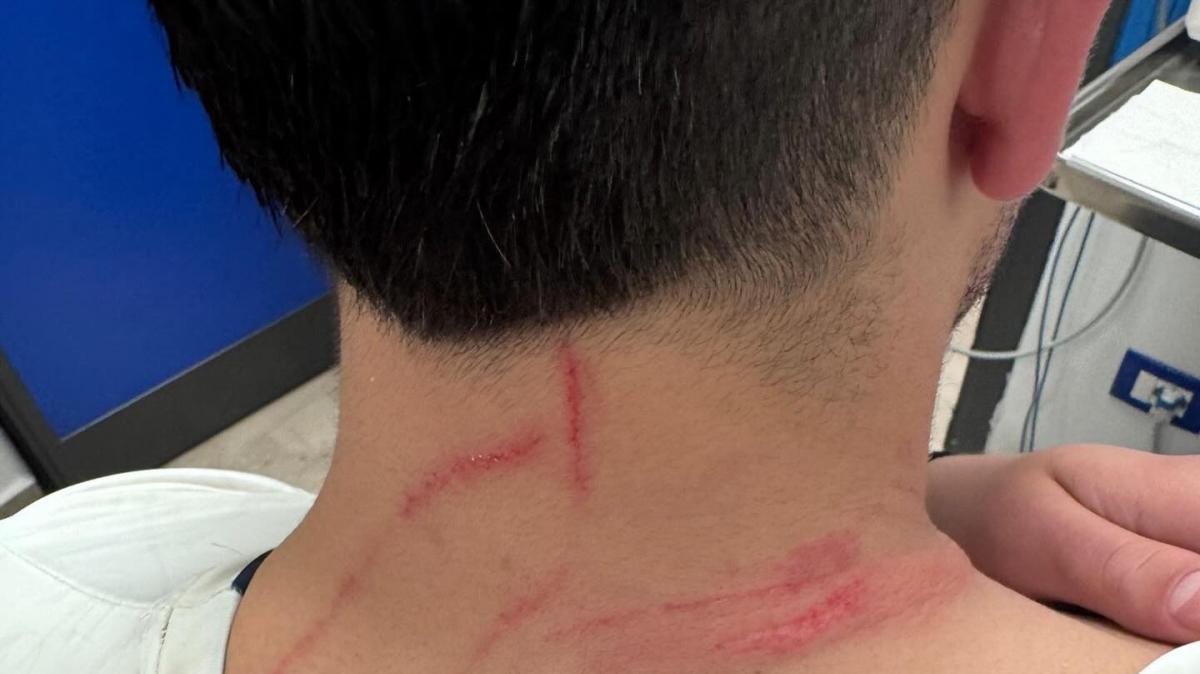 2^-Il Città di Sant'Agata denuncia: aggressione contro un tesserato