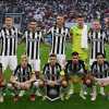 Champions, un giocatore del Newcastle rischia di saltare la sfida con il Milan