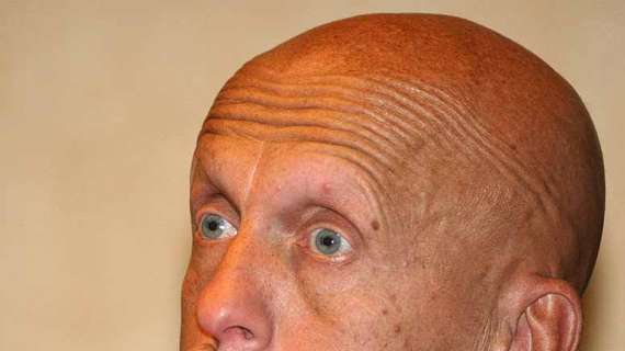 Collina allestisce la sua squadra