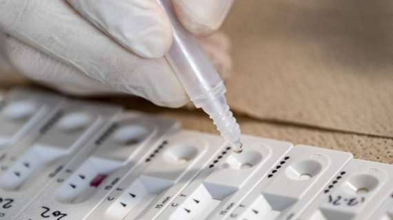 Coronavirus, Federlab eseguirà tamponi e test anti-spike per gli atleti