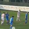 Brutto gesto: con una gomitata gli rompe il naso, è successo in Serie D