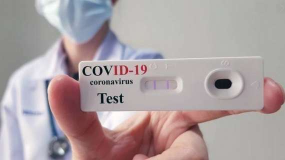 Reggina, buone notizie dai test antigenici