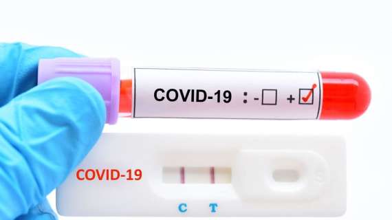Covid-19, tampone positivo per un tesserato della Correggese. Allenamenti sospesi