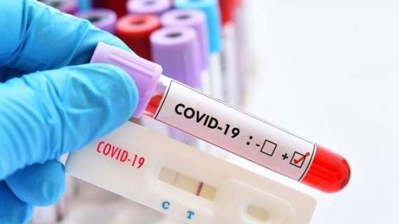Coronavirus, il bollettino: in Italia è nuovo record di nuovi contagi 24.991 nuovi contagi e 205 morti