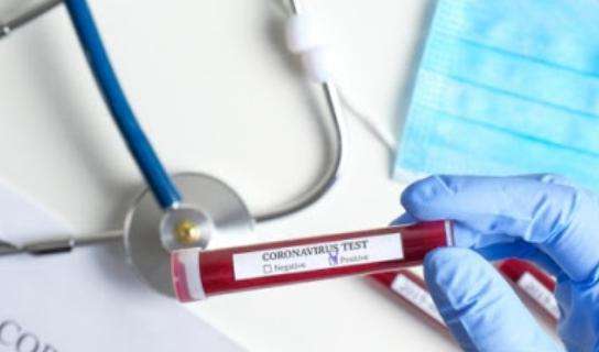Coronavirus, il bollettino: in Italia 5.901 nuovi contagi e 41 morti