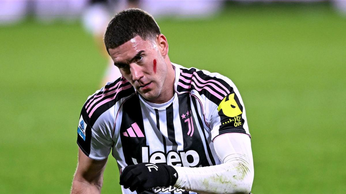 Vlahovic si opera: la Juve lo perde fino a marzo. Salta il ritorno col Parma