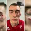 Incredibile in Serbia: James Nunnally tira un pugno a Lazarevic prima di Partizan vs Stella Rossa