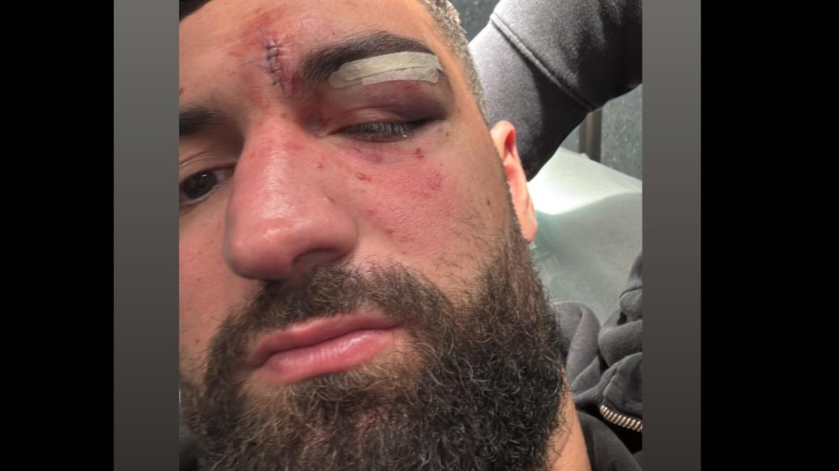 Rissa Choc in A2, Borra squalificato 3 giornate. Aristide Landi: «11 punti... Ci vediamo domani»