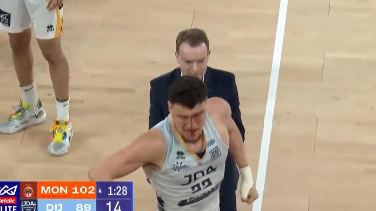 Il Monaco batte Digione ma finisce in rissa: le immagini 