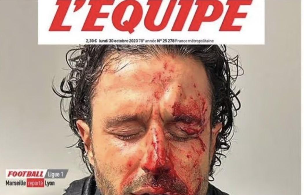 Grosso e gli incidenti in Marsiglia-Lione: "Ogni tanto sul pullman mi capita di rivivere quei momenti"