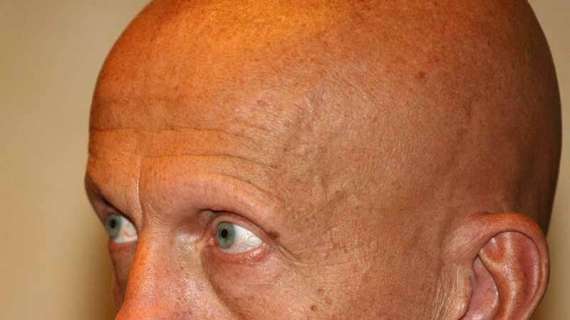 Collina ferma due guardalinee: pagano il rigore al Milan e il gol annullato al Toro 