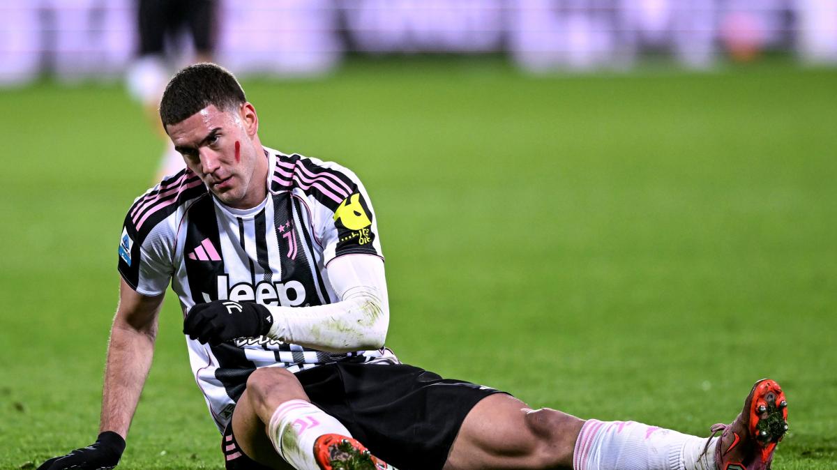 Juventus, Vlahovic rischia uno stop di due mesi 