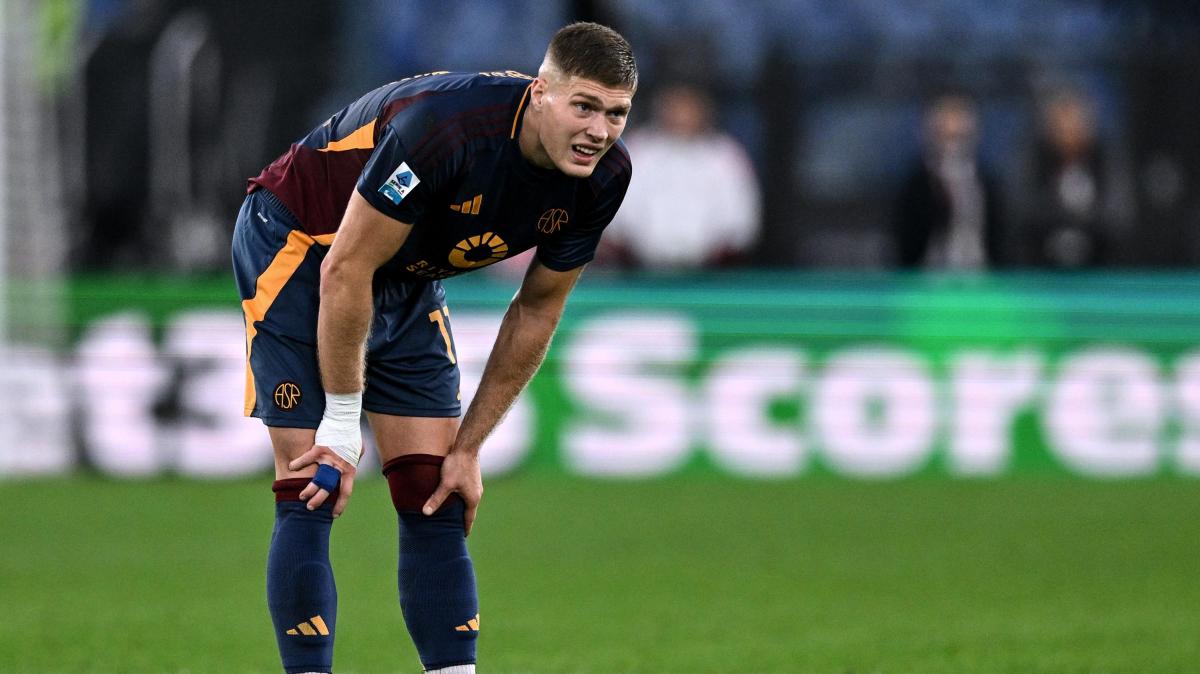 Roma, mazzata Dovbyk: operazione e lungo stop. La corsa Champions perde un protagonista