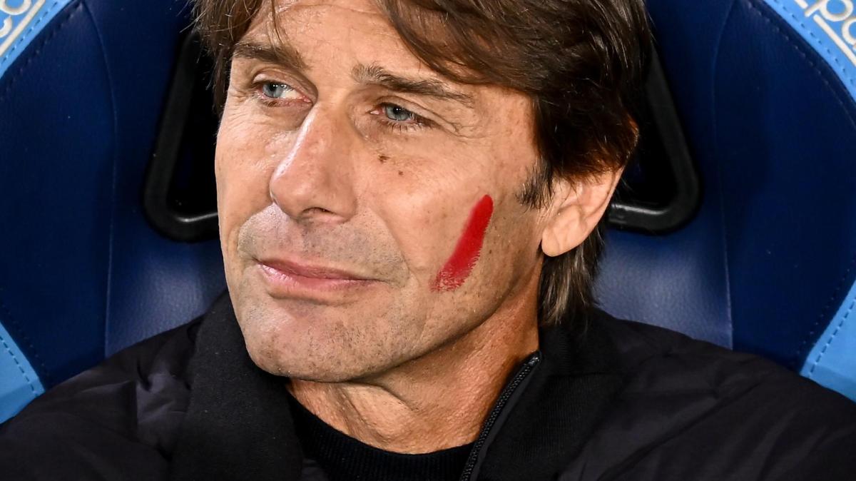 Ottavi di Coppa Italia: Conte fa i conti con gli acciacchi