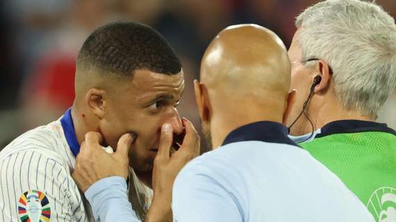 Euro 24: Francia, frattura al naso per Mbappé. Sarà operato subito