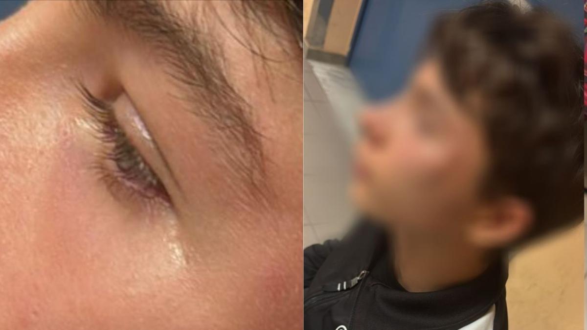 L’arbitro aggredito in Ginosa-Laterza ospite di Lecce-Pisa: si schiererà con gli ufficiali di gara