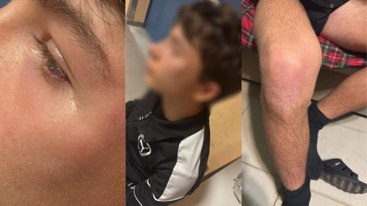 Calcio giovanile, aggressione a un giovane arbitro: interviene l’AIA