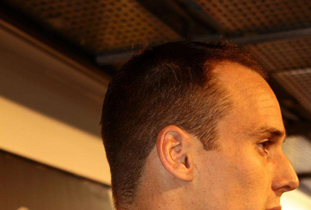Contusione mandibolare per Von Bergen in allenamento