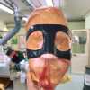 FOTO - Meret come Osimhen: ecco la maschera  con cui giocherà per un problema al naso