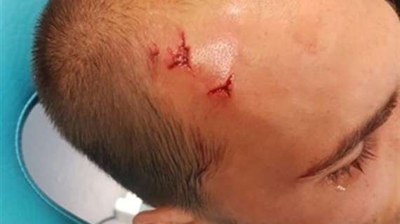 Caos Sporting Lisbona: alcuni giocatori pronti a chiedere la rescissione dopo l'aggressione
