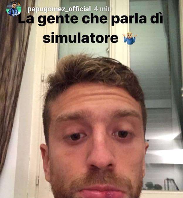 "La gente parla di simulatore...": Papu Gomez mostra il labbro rotto da Lichtsteiner