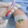 Ecco quali esame del sangue deve fare il podista per capire se è in forma e come intervenire