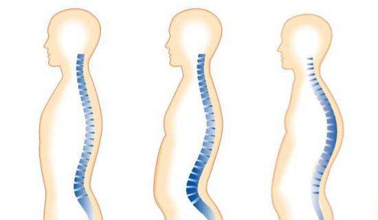 La corsa vi ha fatto soffrire di mal di schiena? Allora ecco cosa dovete fare 