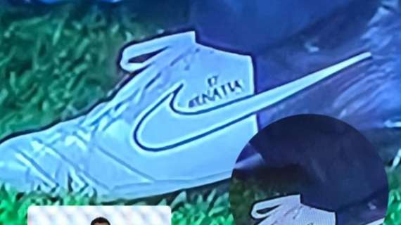 Le scarpe speciali del medico dell'Udinese: sono quelle di Benatia