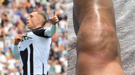 Udinese, come sta Deulofeu? Le condizioni del suo ginocchio