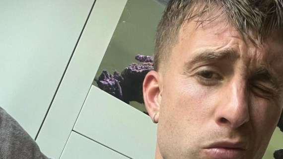 Udinese, nuovo messaggio di Deulofeu: "Never give up"