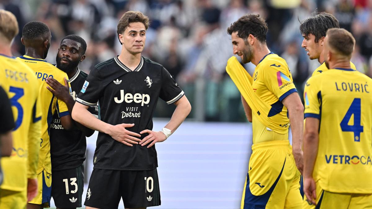 Juventus, problemi muscolari per Yildiz: derby a rischio