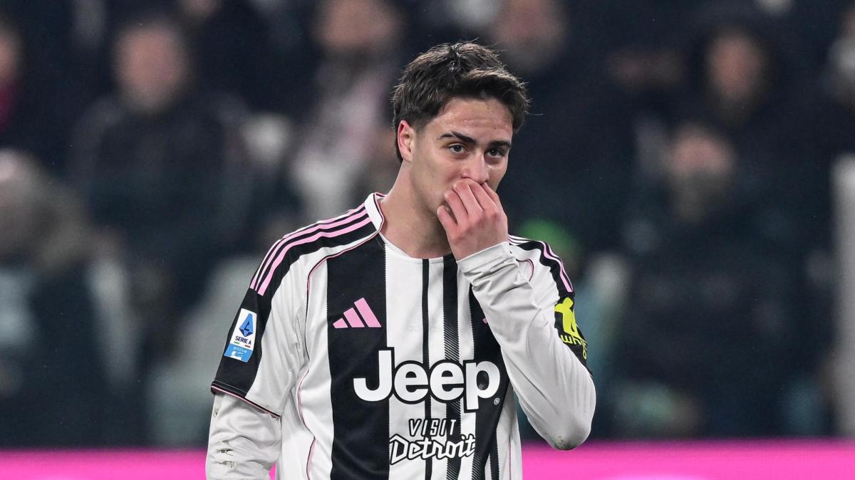 Roma-Juventus, Yildiz in dubbio dopo una botta alla caviglia 