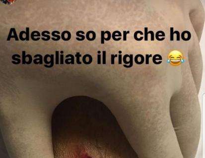 Instagram, Perotti scherza sulla ferita: "Adesso so perché ho sbagliato il rigore". Fazio: "Ti ha morso uno zombie"